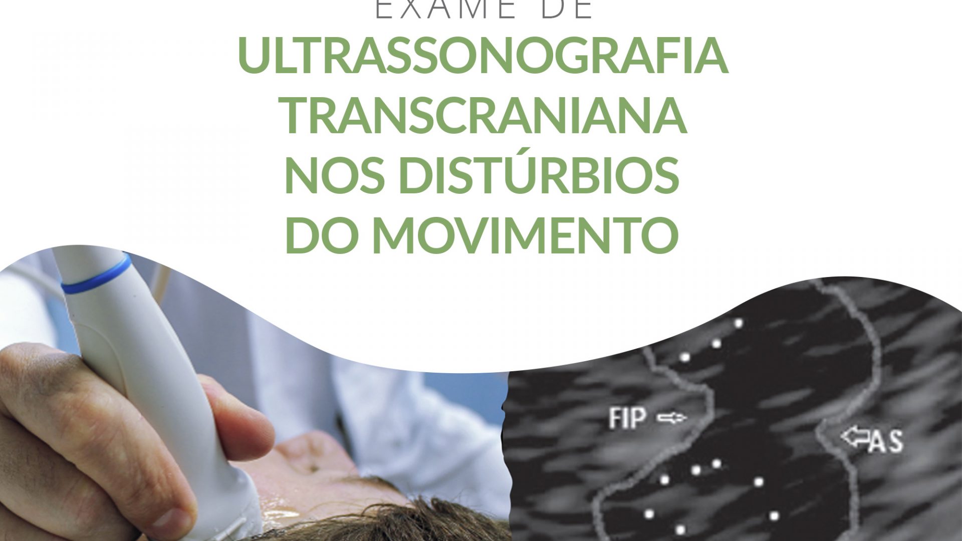 Ultrassonografia Transcraniana nos Distúrbios do Movimento