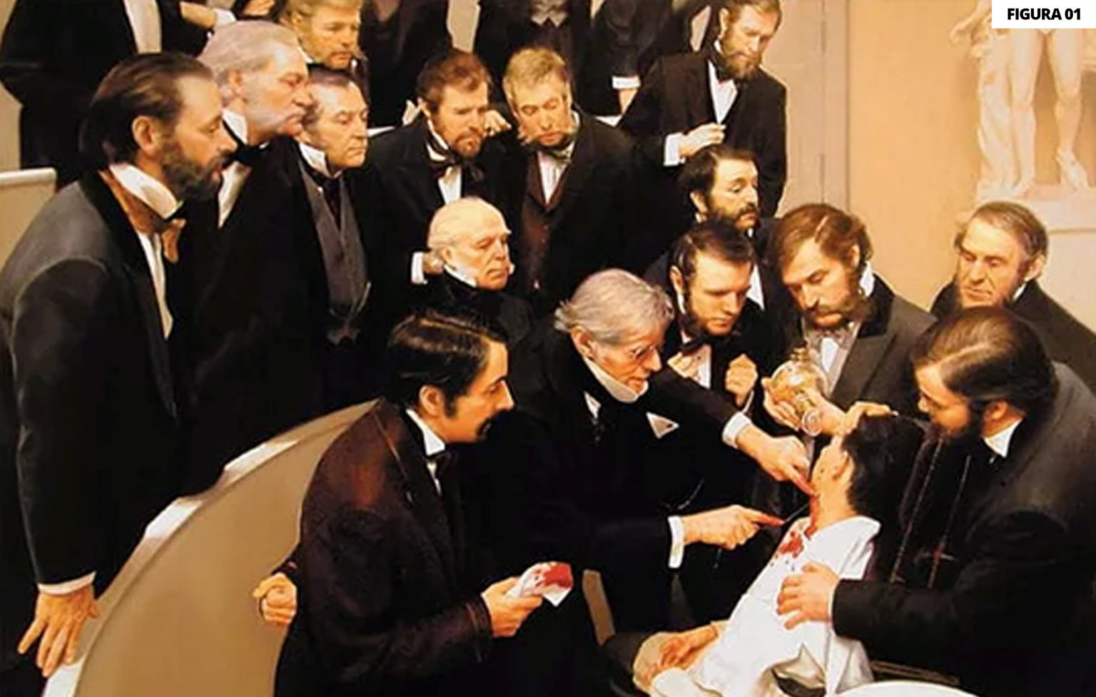 Figura 1 - Tela retratando uma anestesia com éter em 1846