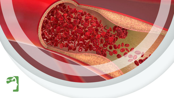 Cientistas encontram microplásticos no sangue humano
